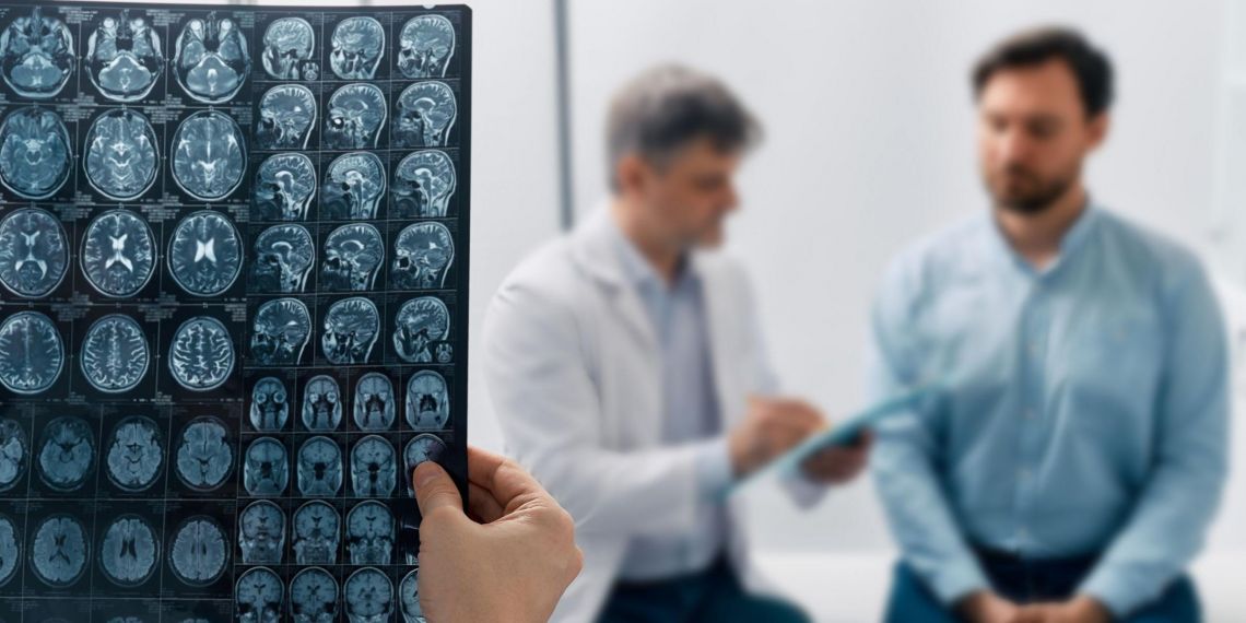 Pourquoi l’AVC reste une urgence (encore) mal gérée en France ?