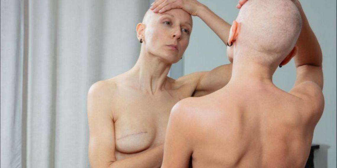 Cancer du sein : pourquoi la France dépiste encore trop tard le cancer le plus fréquent chez les femmes ?