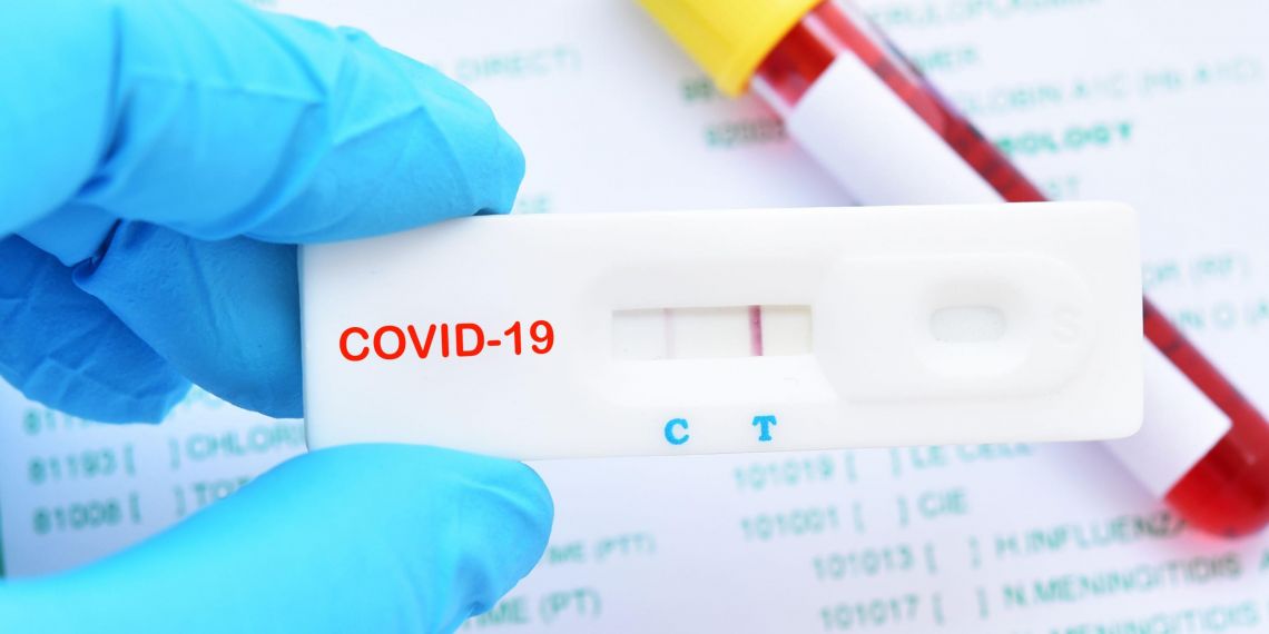 Covid-19 : tests de dépistages sans prescription et masques pour les plus précaires