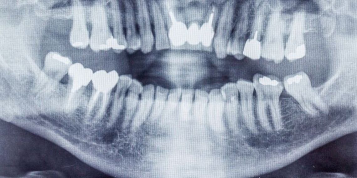 A compter du 15 octobre 2023, vos soins dentaires vous coûteront plus cher