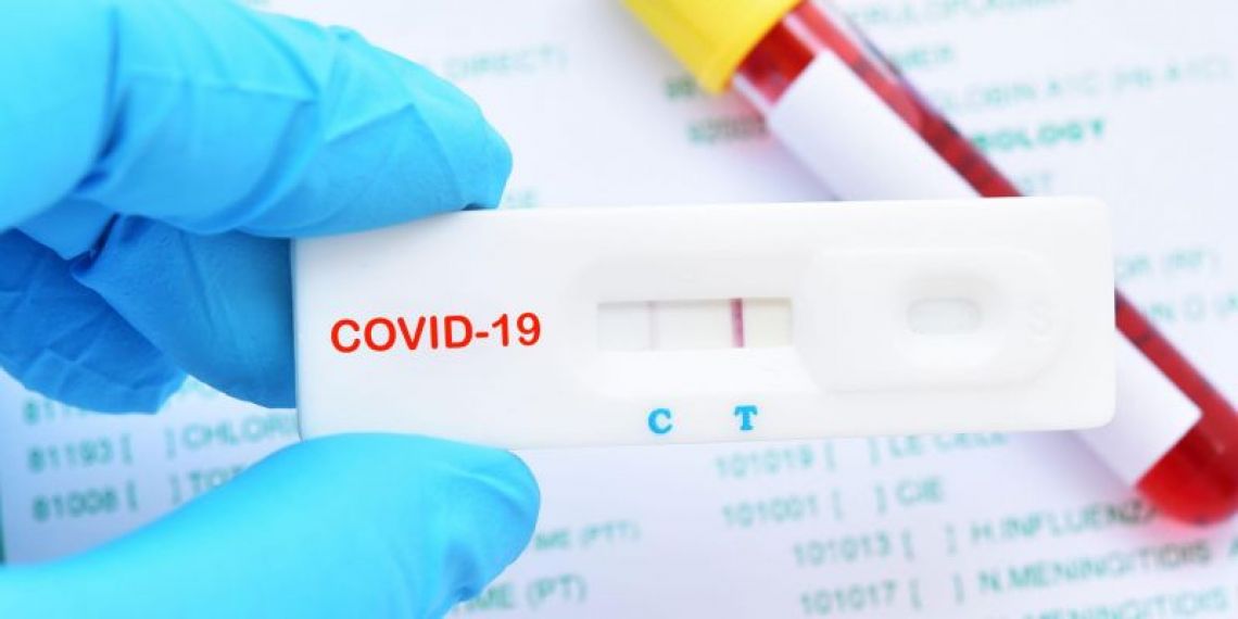 Pour le BOSS, le coût d'un test Covid-19 ne constitue pas un frais professionnel… à une exception près